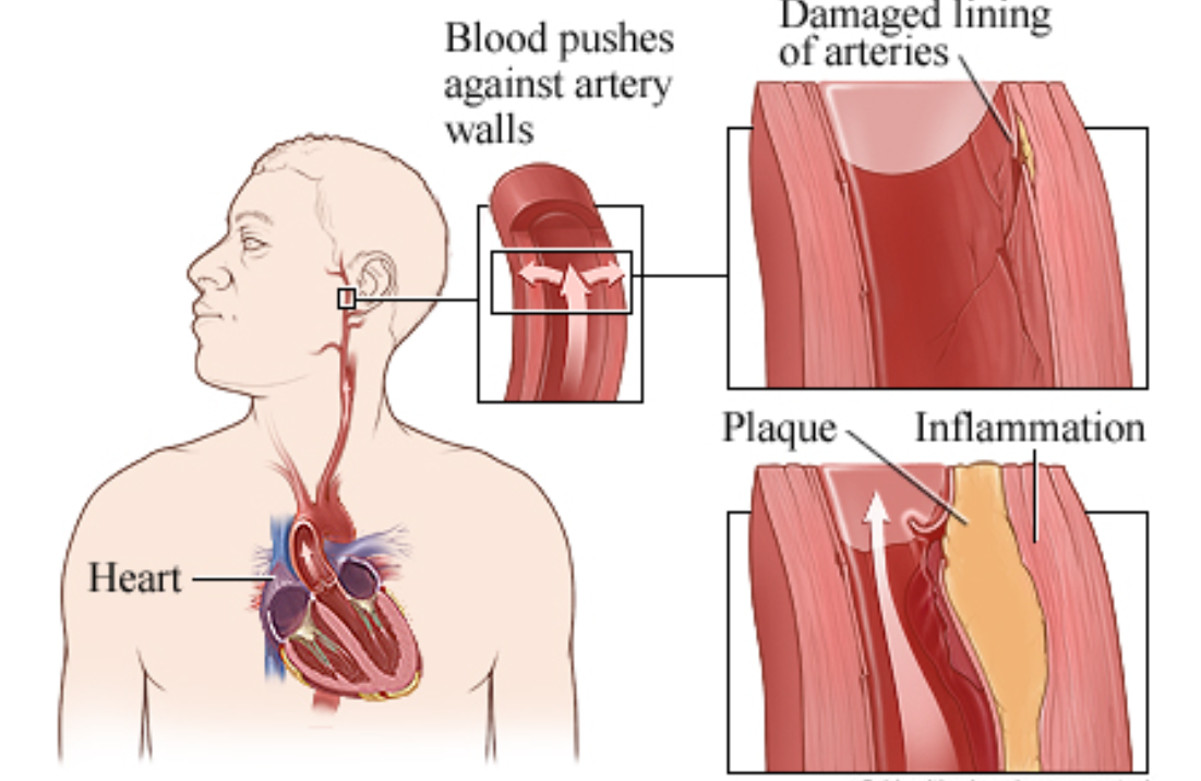 晨勃越来越少，是身体在报警吗？很多南阳男性忽视了这个信号