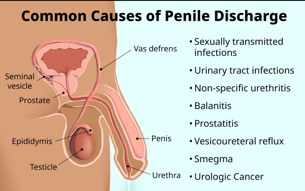 龟头反复发红，是包皮炎还是性病？很多南阳男性第一步就走错了