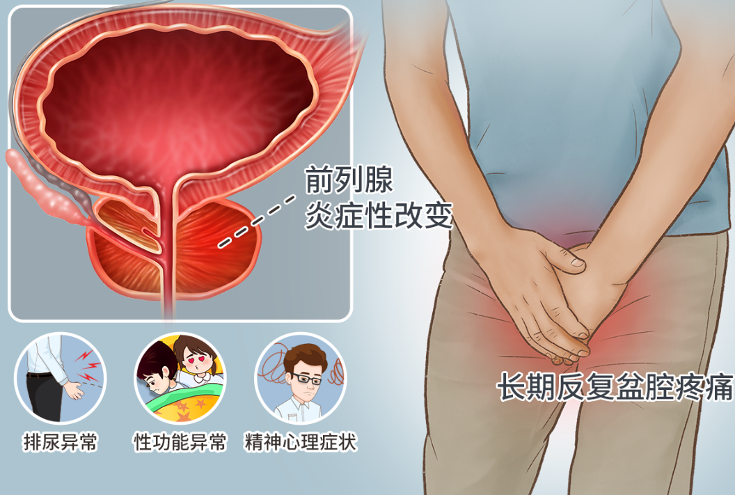 勃起没问题，但时间很短？很多人其实是“混合型问题”