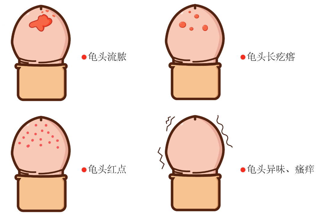 阴茎上出现小红点，是过敏还是感染？很多男人第一次都会紧张