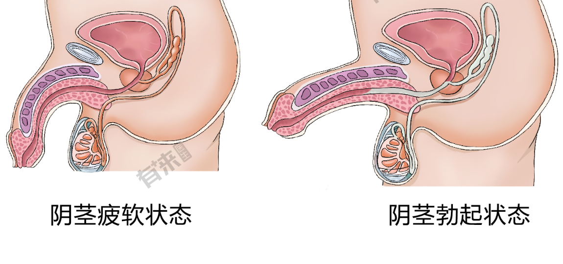 为什么很多男人“硬得慢”？医生提醒：问题可能出在这三个环节