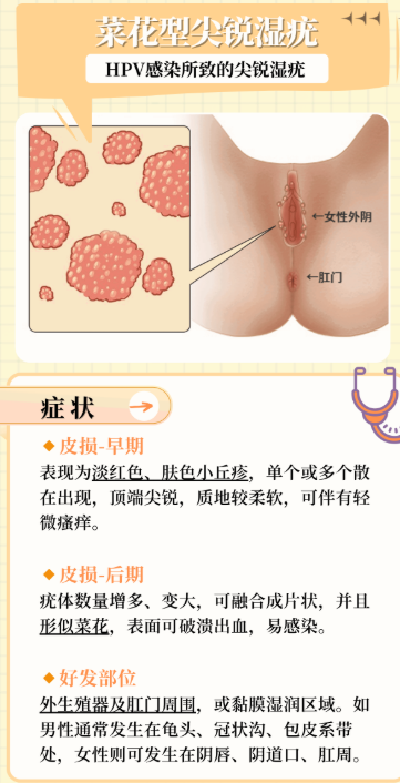 丁丁上长“小疙瘩”是怎么回事？很多男性其实误会了