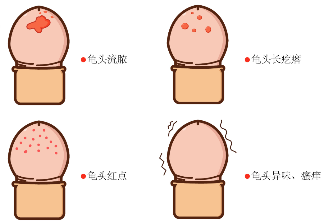 生殖感染总反复？南阳清大专家团队详解靶向清除逻辑