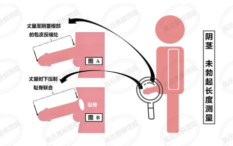 南阳包皮手术美学与规范指南：清大医院解析微创技术，拒绝非正规诱导与隐私泄露