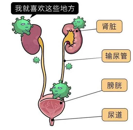 小便不舒服、还有分泌物？很多男性忽略了“尿道炎”的早期信号