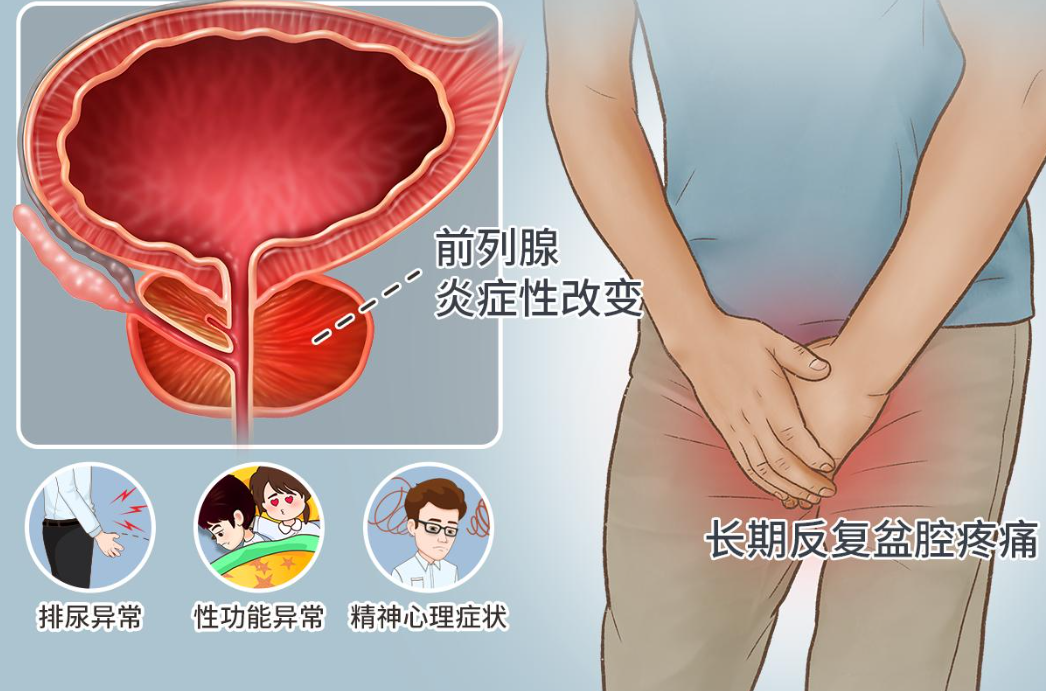 私处瘙痒、发红、有异味？很多男性其实是“龟头炎”反复发作