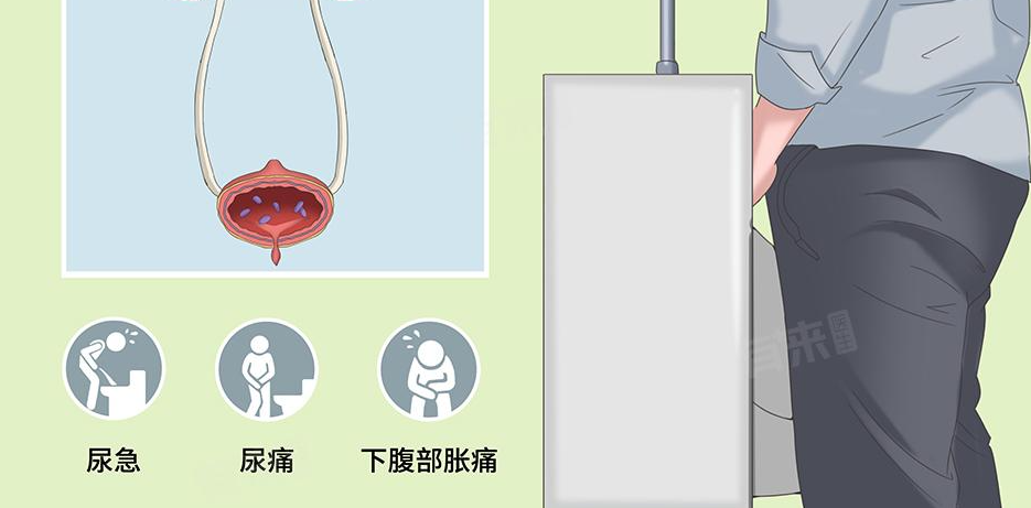 如何判断自己有没有性病？很多人一开始都忽略了这些信号