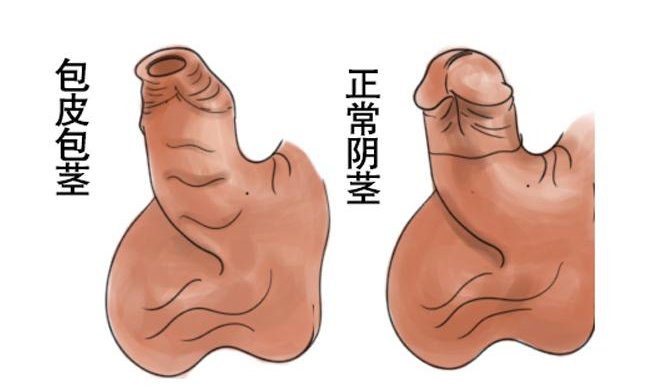 南阳男人要不要割包皮？不是所有人都需要，但这几种情况建议重视